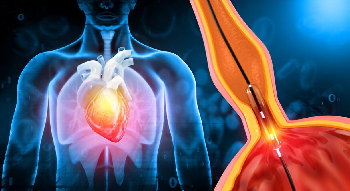 The Role of Interventional Cardiology in Managing Cardiovascular Health